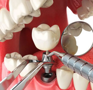 Наша клиника используем новейшие стоматологические технологии